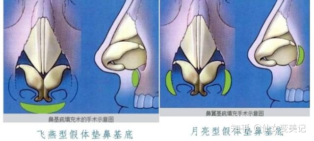 鼻子越来越大，到底有没有科学依据？年纪越大，鼻子越大？