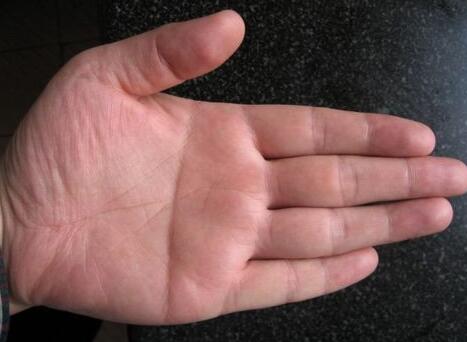 手掌中的纹路交错纵横，你知道什么是断掌纹吗？