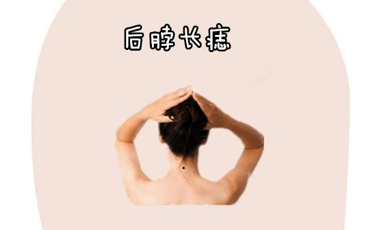 脖子后有痣算命说法脖子后面的是苦情痣?