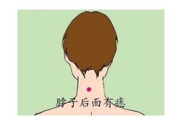 脖子后有痣算命说法脖子后面的是苦情痣?