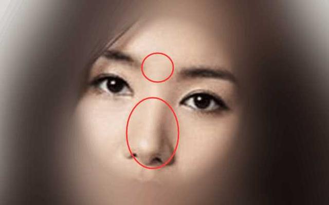 女人鼻子上的痣图解侧边，鼻梁处于双眼之间