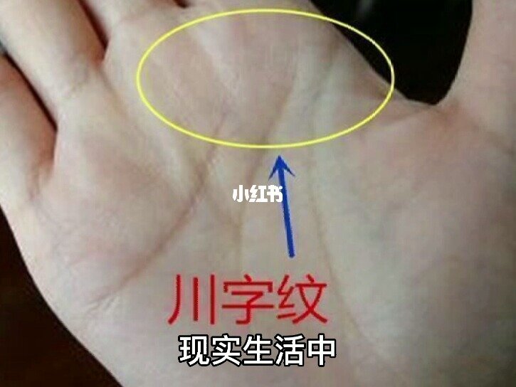 三条主线不相连的掌纹被称为川字纹