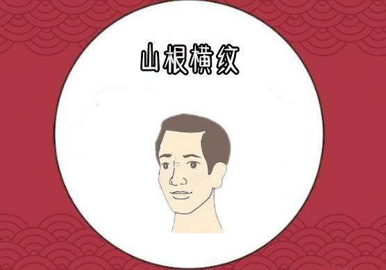 男人山根有横纹好吗？看看你是不是其中之一