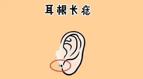 女人耳朵上的痣代表什么，不同位置长痣有什么含义