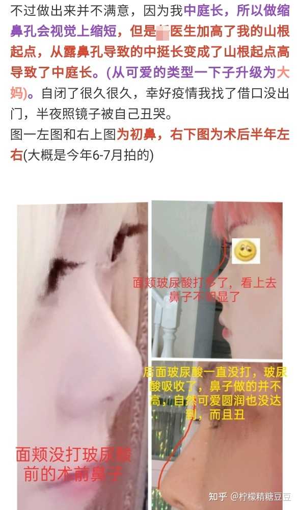 “女眼男鼻”男生鼻子塌，真的很难好看，但吴磊应该是个例外吧