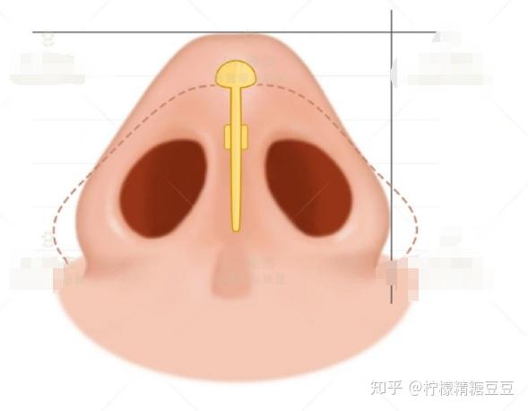 “女眼男鼻”男生鼻子塌，真的很难好看，但吴磊应该是个例外吧