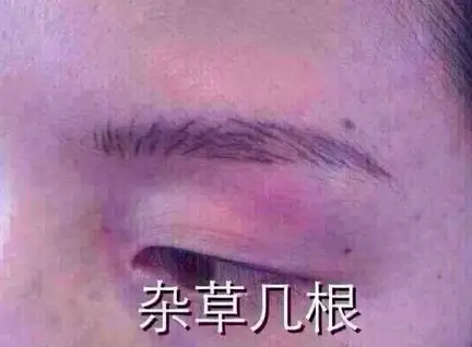 （李向东）嘴唇歪斜的几种征兆，你有吗？