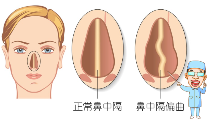 做鼻整形手术时遇到的一些鼻型，来感受一下