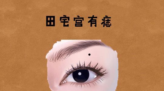 痣相看人生富贵：鼻旁痣、眼下痣对人生运势的影响